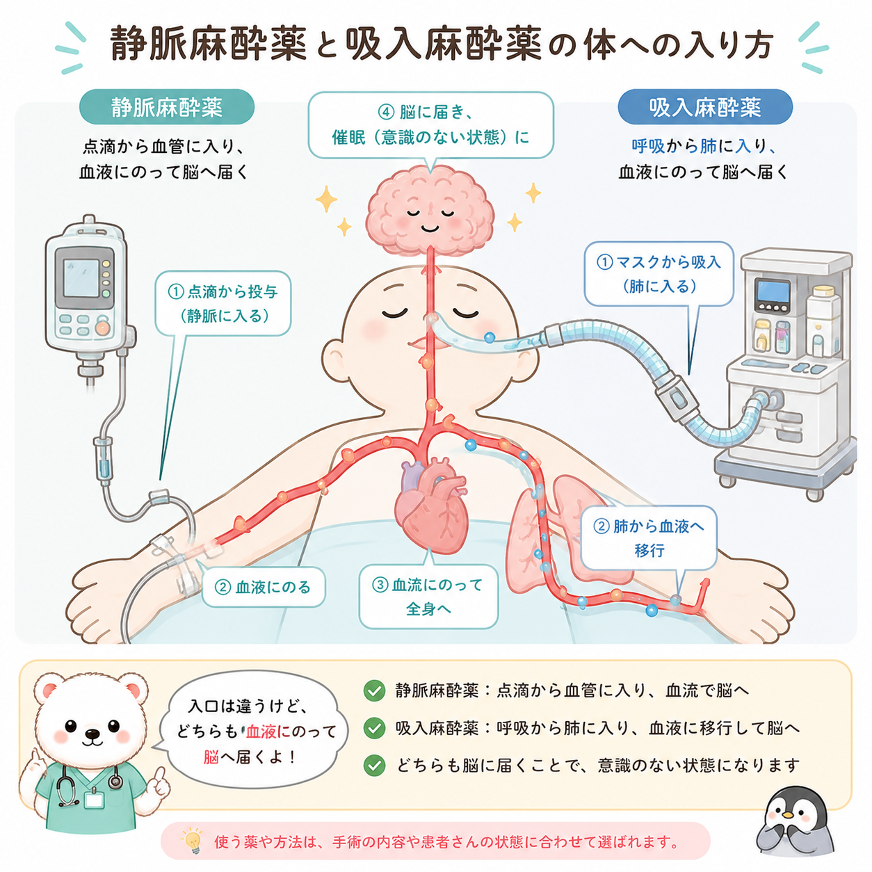 静脈麻酔と吸入麻酔のルートの違い
