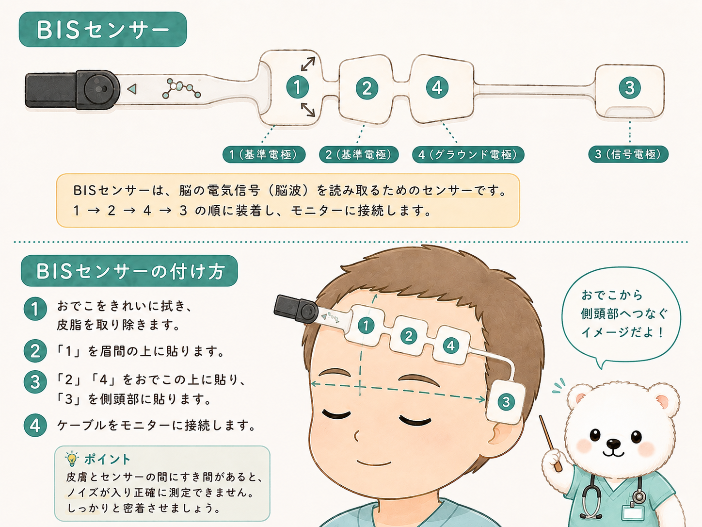 BISセンサー