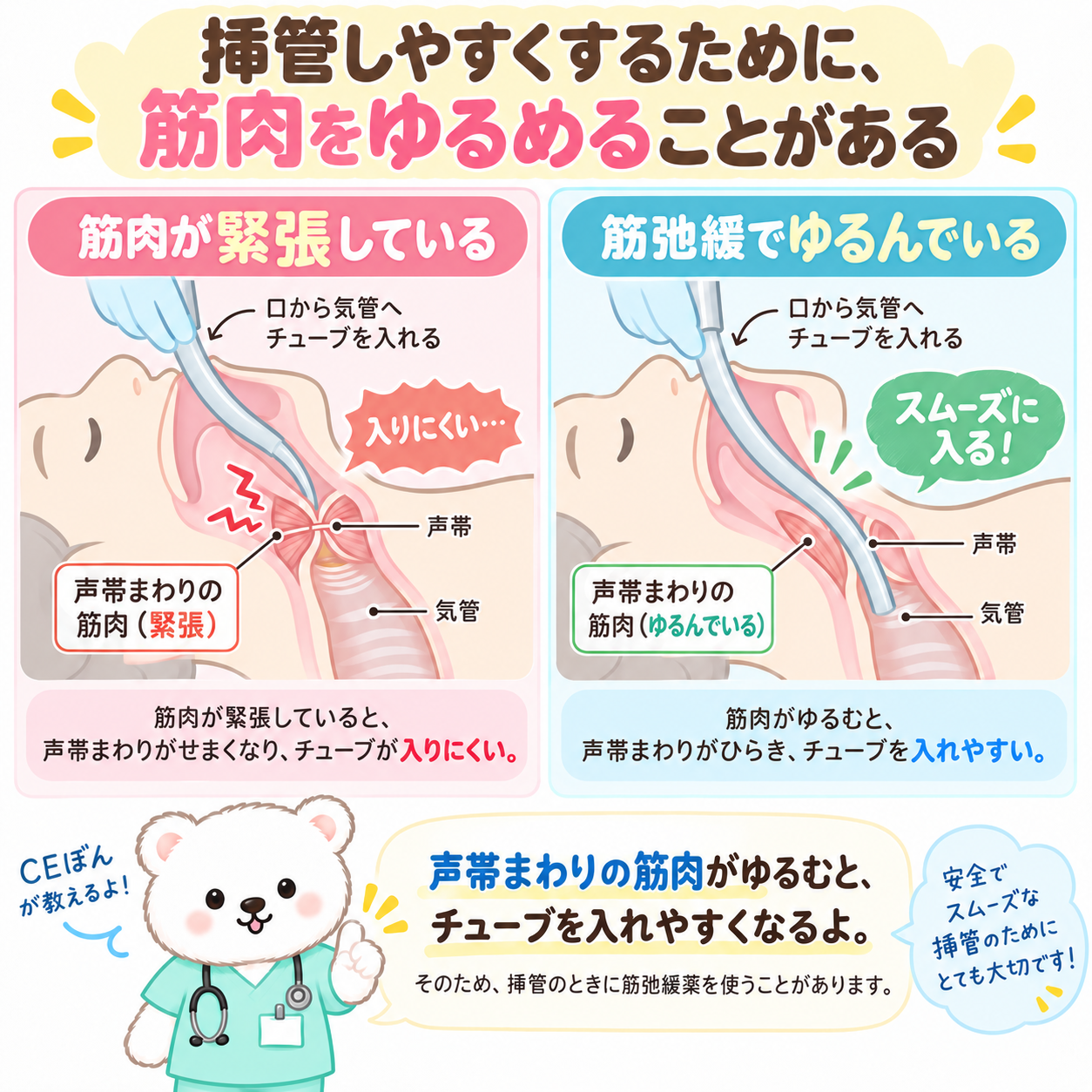 挿管時の筋肉の緊張